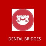 Dental Bridge Bangalore