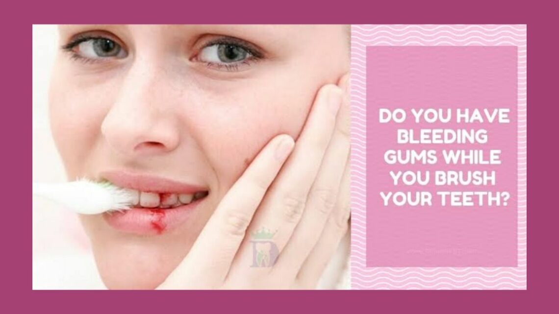 Why Do My Gums Bleed When I Brush?