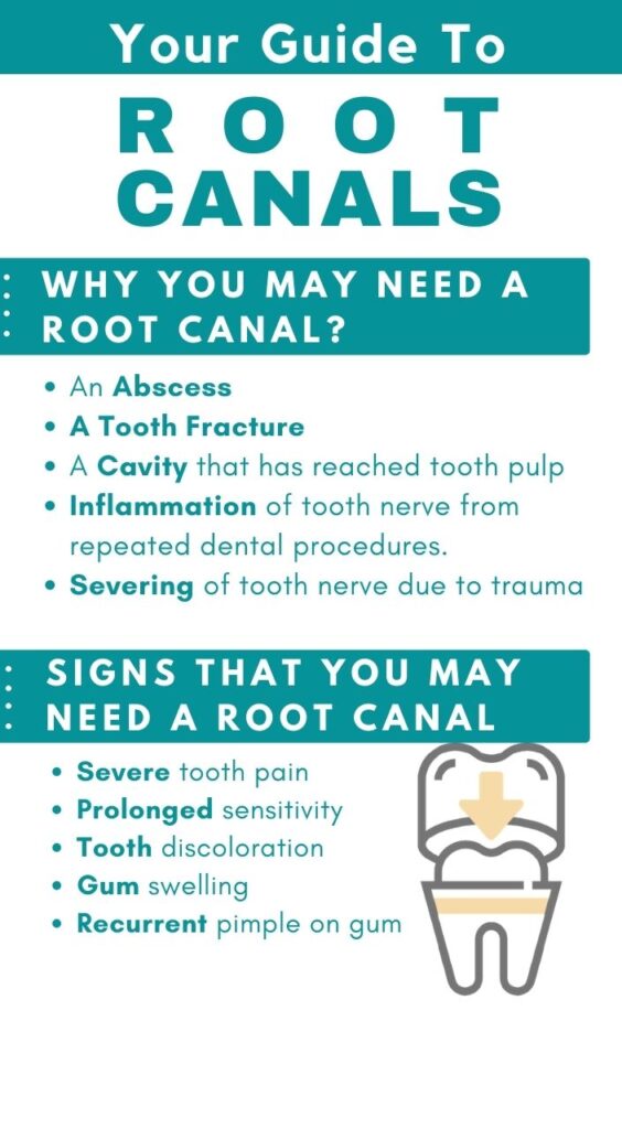 Why do You Need A Root Canal Treatment