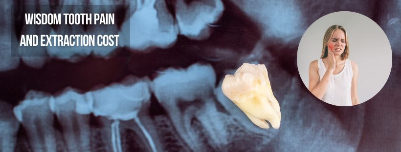 Wisdom tooth pain and extraction cost